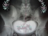 Xray-Fruits-of-her-Loins